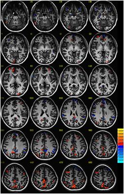 Brain Injury and Mental Health Among the Victims of Intimate Partner Violence: A Case-Series Exploratory Study